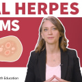 Understanding Herpes Symptoms: What You Need to Know