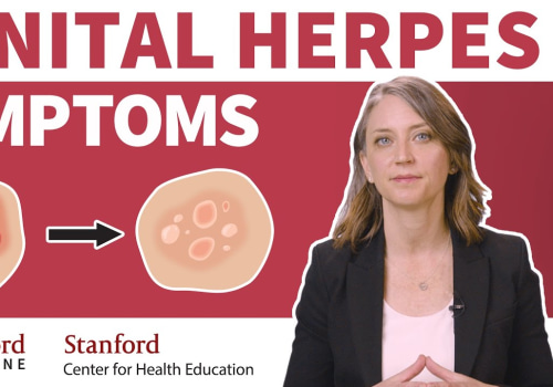 Understanding Herpes Symptoms: What You Need to Know